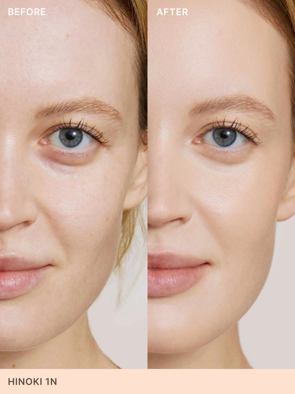 The Skin Rewind Set 5 The Skin Rewind Set